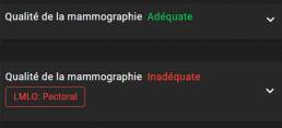 interface mammoscreen qualité des images
