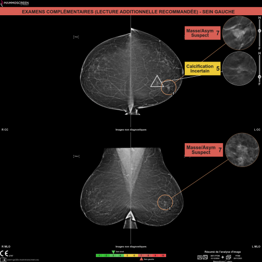 capture d'ecran mode d'integration dicom SC de mammoscreen